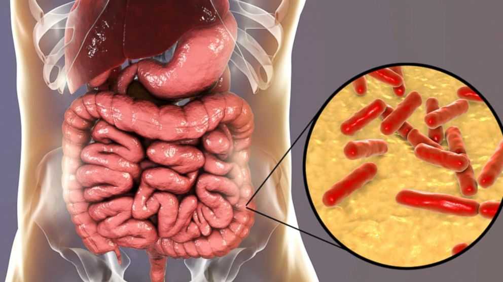 Was bewirkt Probiotikum?