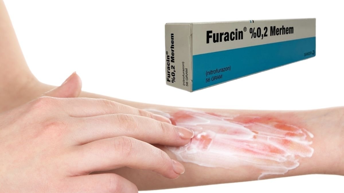 what is furacin ointment