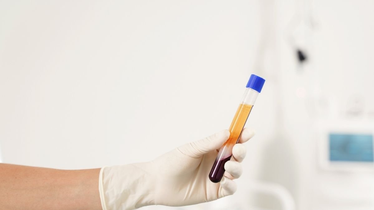 Valores normales de análisis de sangre PLT