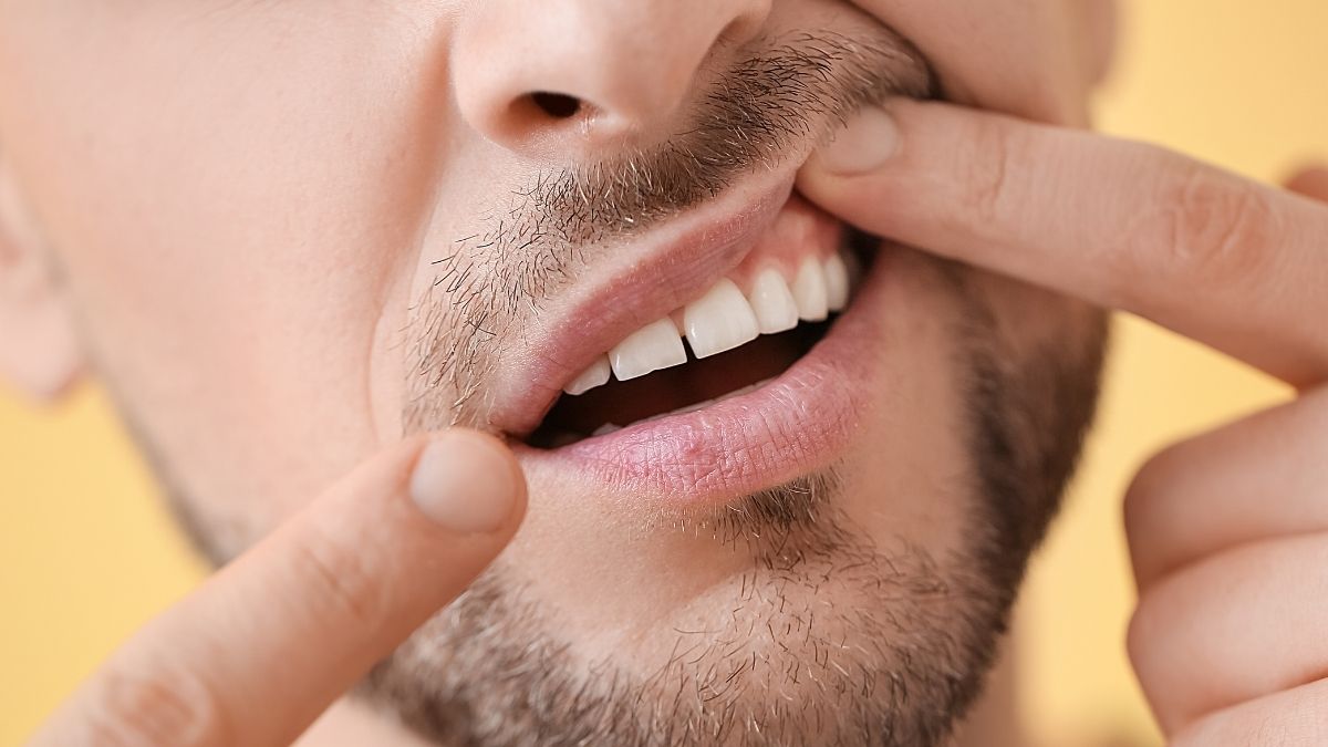 what is good for gum recession