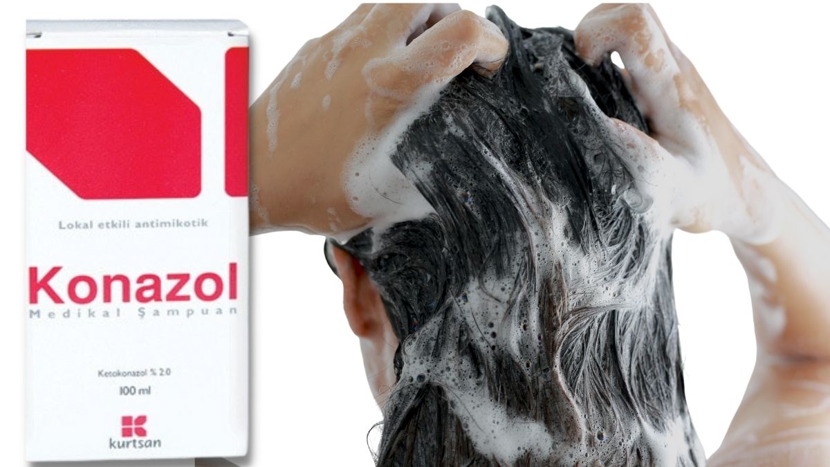 what is conazole shampoo