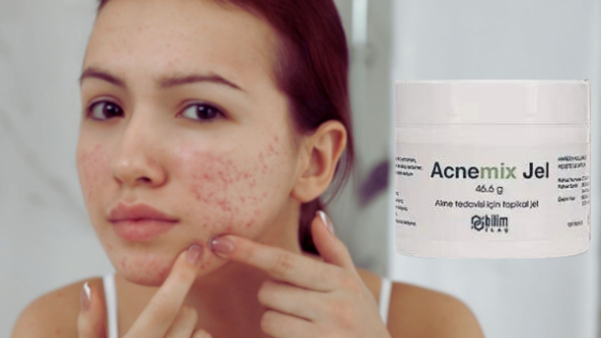 Какво представлява Acnemix Gel? Какво прави? (Потребителски коментари)