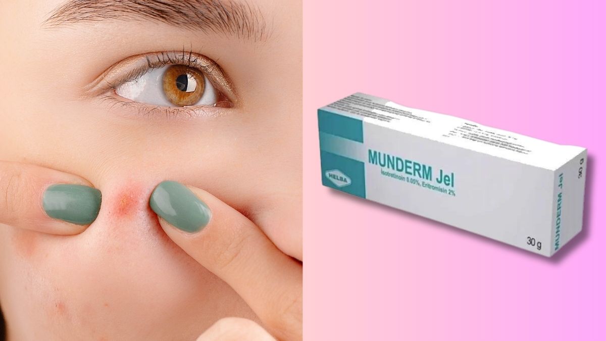 Cosa fa Munderm Gel? Allevia le cicatrici da acne?