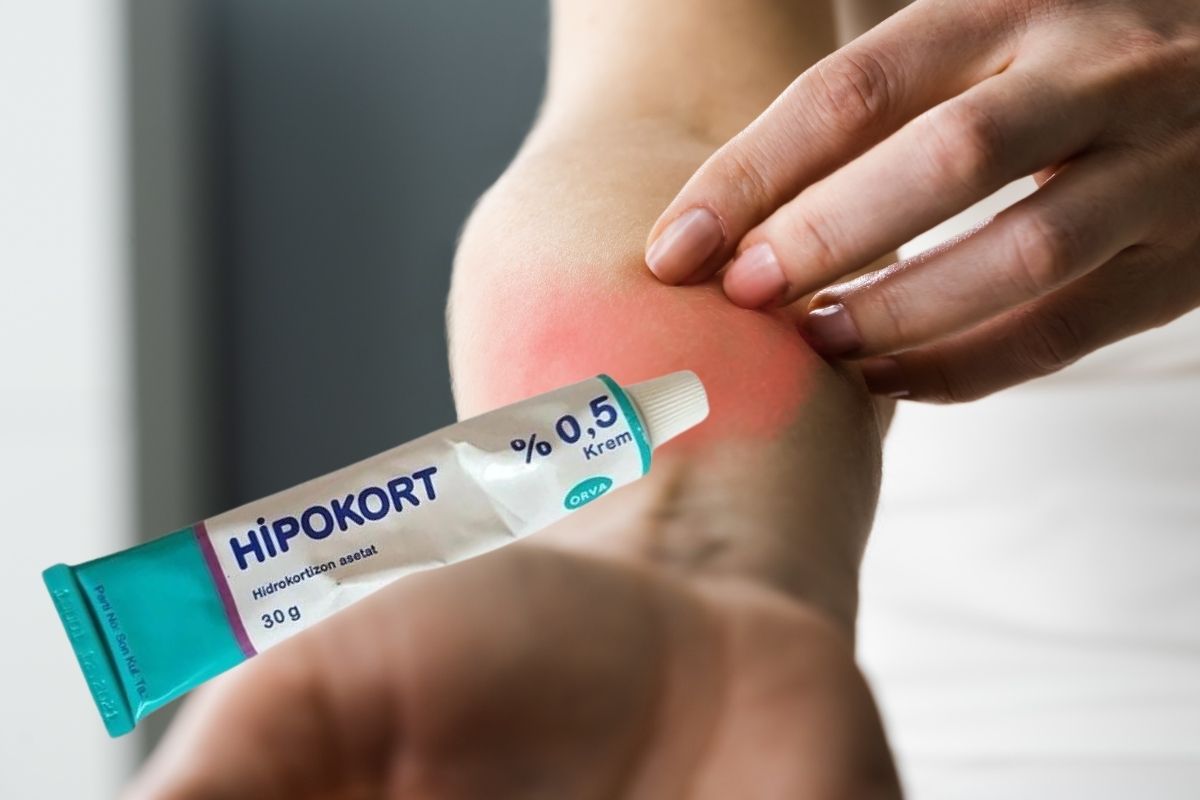 Hvad er Hypocort Cream